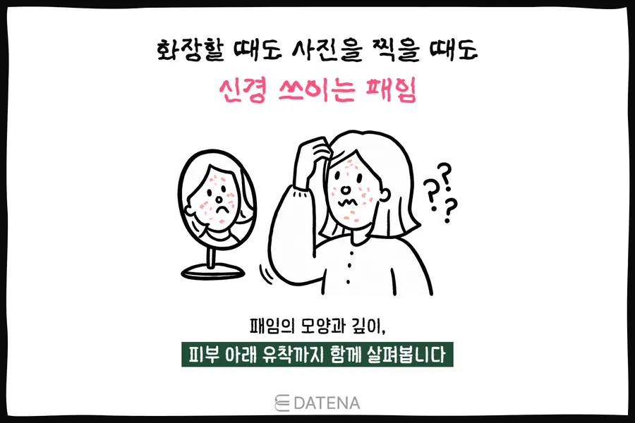 거울 속 볼의 패인 여드름흉터를 살피는 여성과 화장·사진에서 신경 쓰이는 패임을 표현한 그림