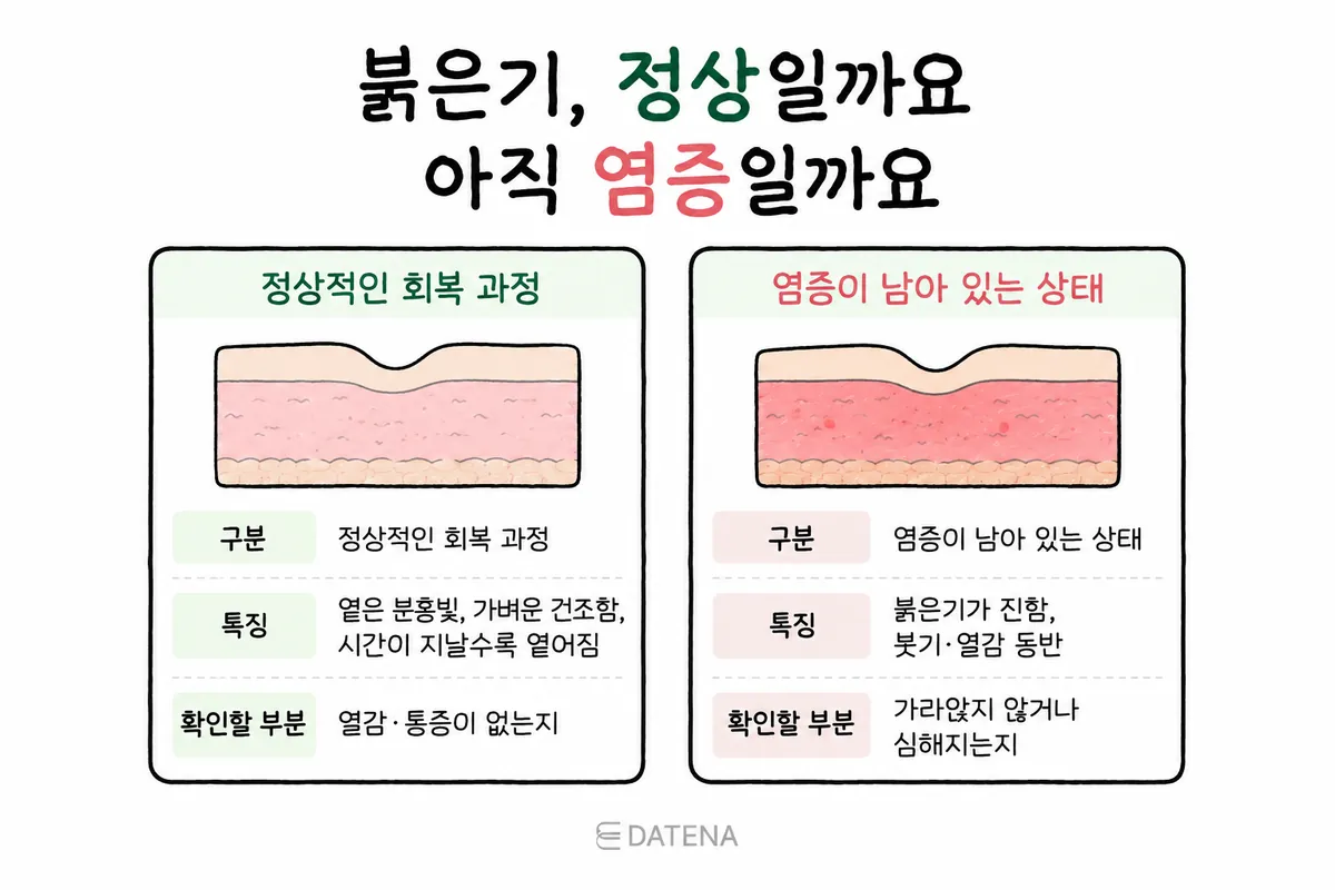 옅어지는 붉은기와 부기·열감이 동반된 붉은기를 비교한 피부 상태 그림