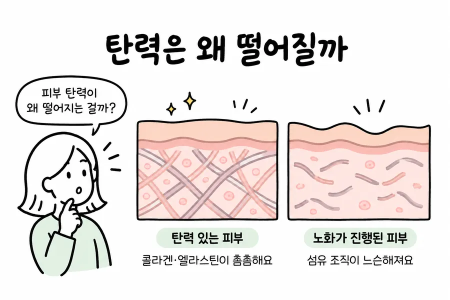 섬유 조직이 촘촘한 피부와 느슨해져 굴곡이 생긴 피부를 비교한 단면 그림