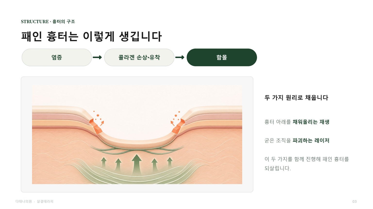 살결테라피 상담자료 3